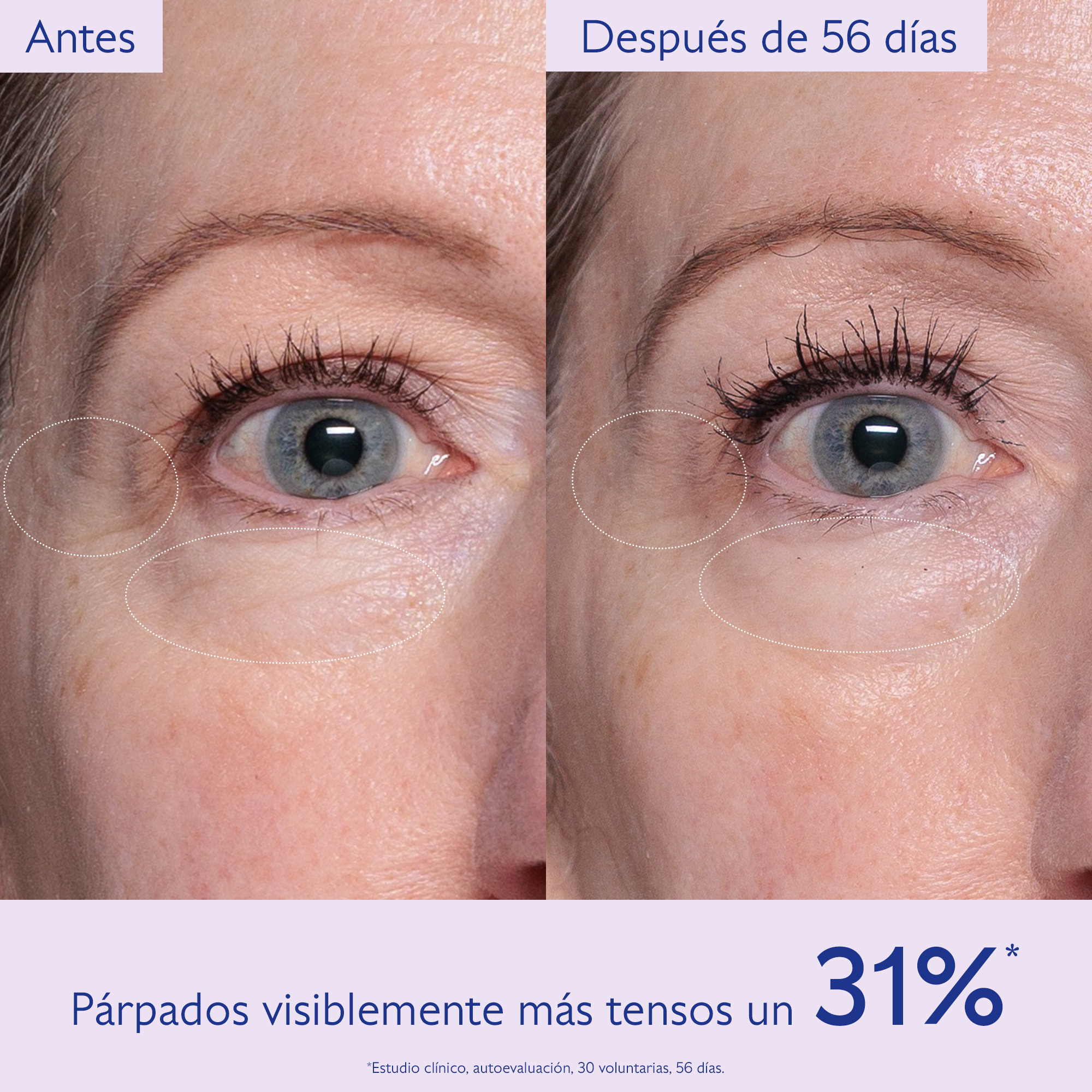 RESVERATROL-LIFT EYE GEL (CREMA REAFIRMANTE DE OJOS)